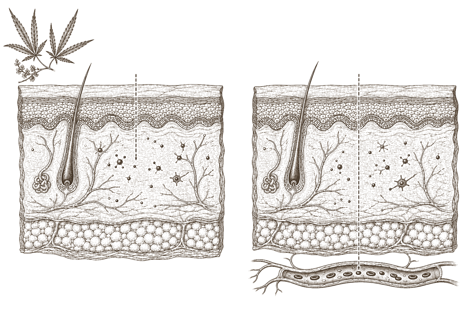 Archival comparison plate — topical localised versus transdermal systemic skin delivery in 19th-century engraving style